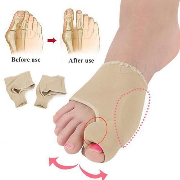 Correcteur d'Orteils,Orthèses pour Pieds, Soins Complets Os  Ajustement du Pouce