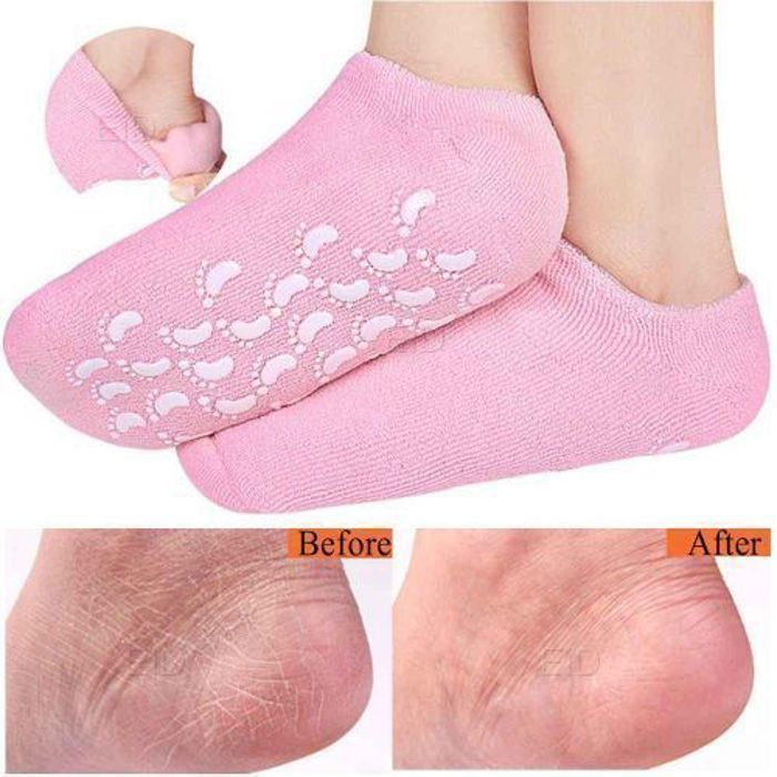 Chaussettes Gel Spa - GENERIC - 2 Paires - Répare et Adoucit - Non Comédogène - 50 ml