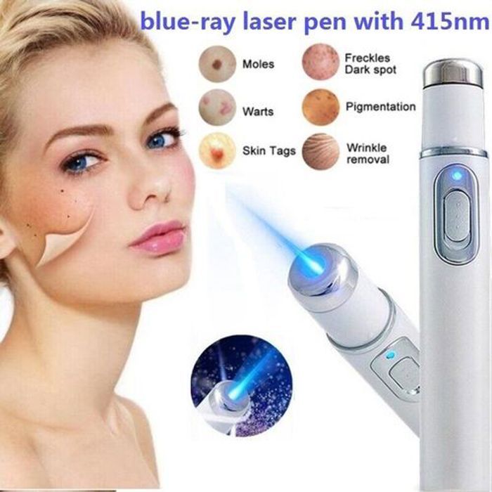 Stylo laser pour l'élimination du déformage de l'acné