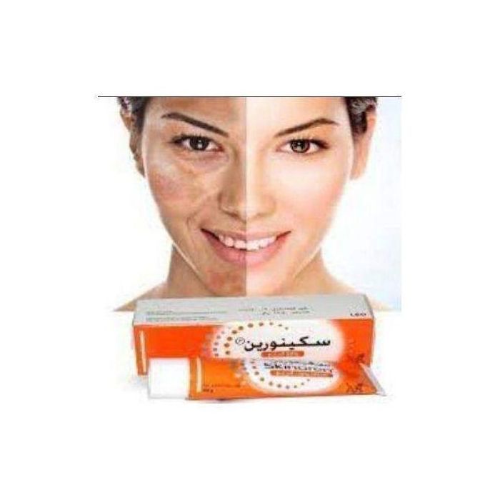 Crème Skinoren Crème azélaïque acide .20%. 30g