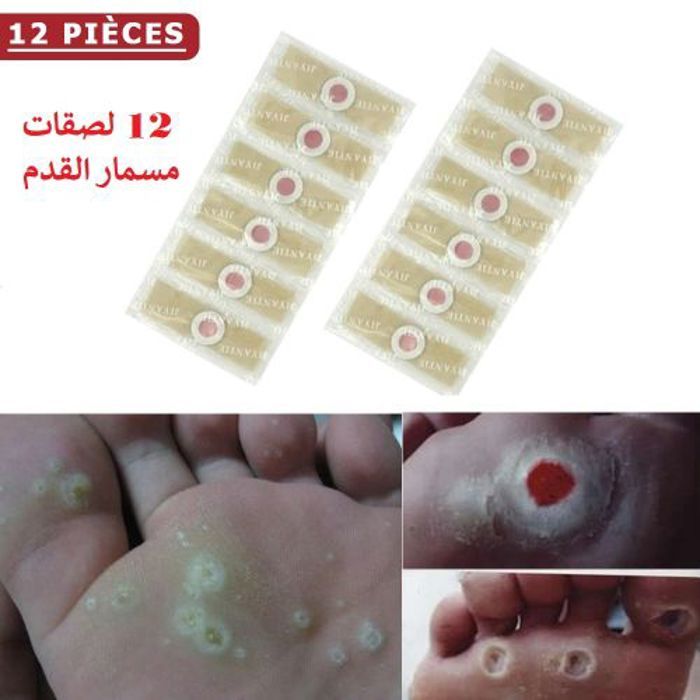 12 pièces Pied De Mais Dissolvant De Plâtre Détox Patch Patchs Médicaux