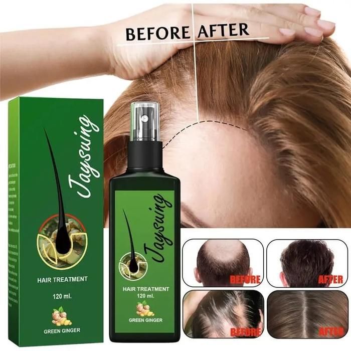 Traitement Capillaire Jaysuing 120mL - Favorise la croissance des cheveux