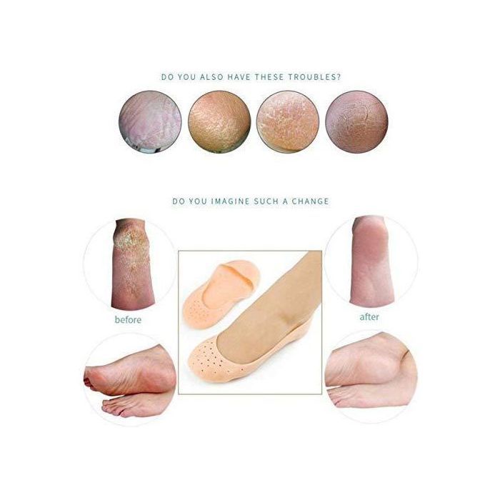 Chaussettes hydratantes en silicone anti-fissures pour le soin des pieds