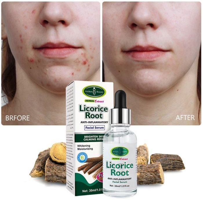 Sérum pour visage à la racine de réglisse, Blanchissant, Anit-taches rousseur, Anti-inflammatoire