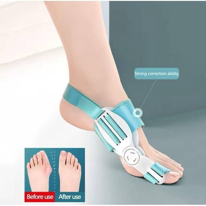 Correcteur d'Attelle de Gros Orteil en Os, Outil de Soin des Pieds, Soulagement de la Douleur, Hallux Valgus, Protecteur