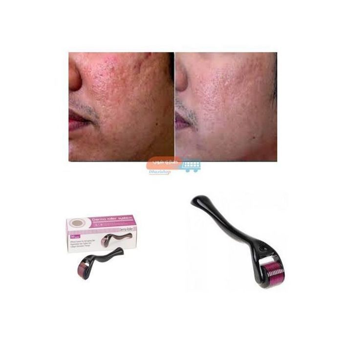 Rouleau Dermatologique : Traitement Anti-Cellulite & Anti-Vergetures - Pour une Peau Lisse & Lumineuse