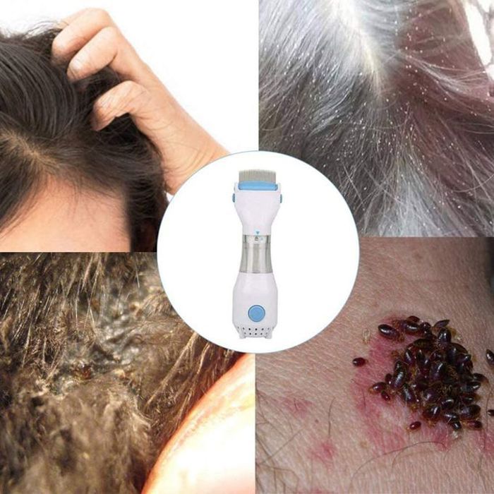 V COMB - Traitement Poux & Lentes, Efficace & Naturel
