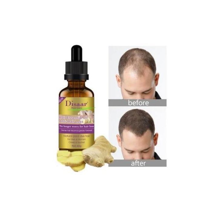 Huile essentielle - Disaar - Gingembre - Anti-chute - 30ml - Tous types de cheveux