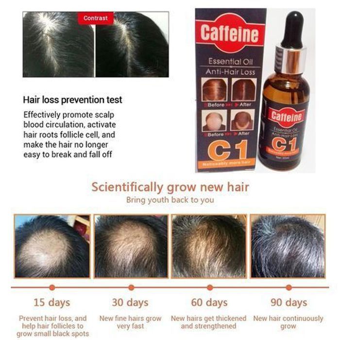 Serum anti perte de cheveux - huile essentielle qui repousse des cheveux
