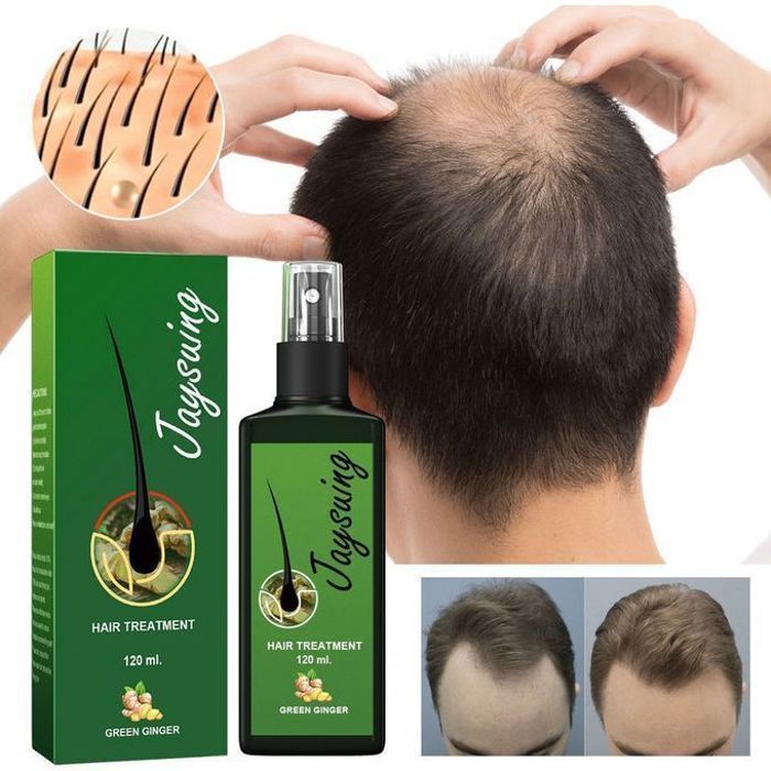 Jaysuing Huile Cheveux Anti Chute 120ml