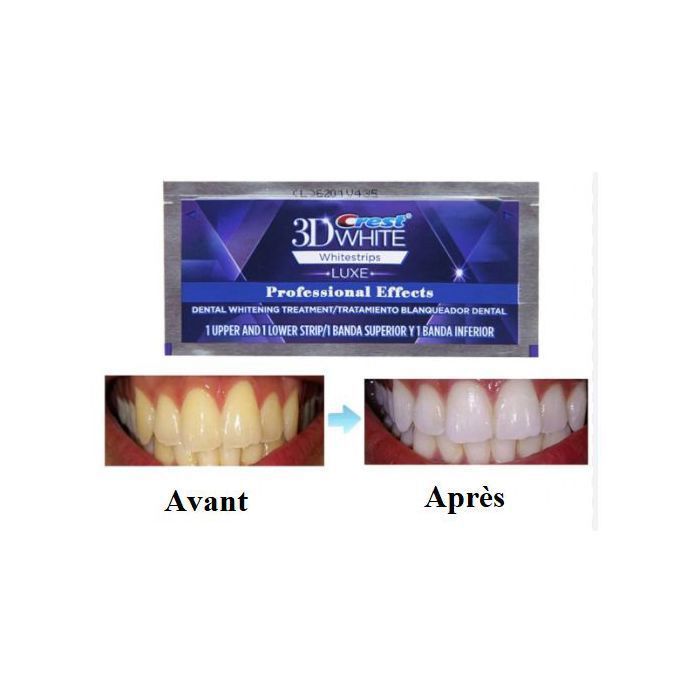 Crest 3D Whitestrips professional effects : 10 bandes = 5 traitements - Résultats en 5 jours