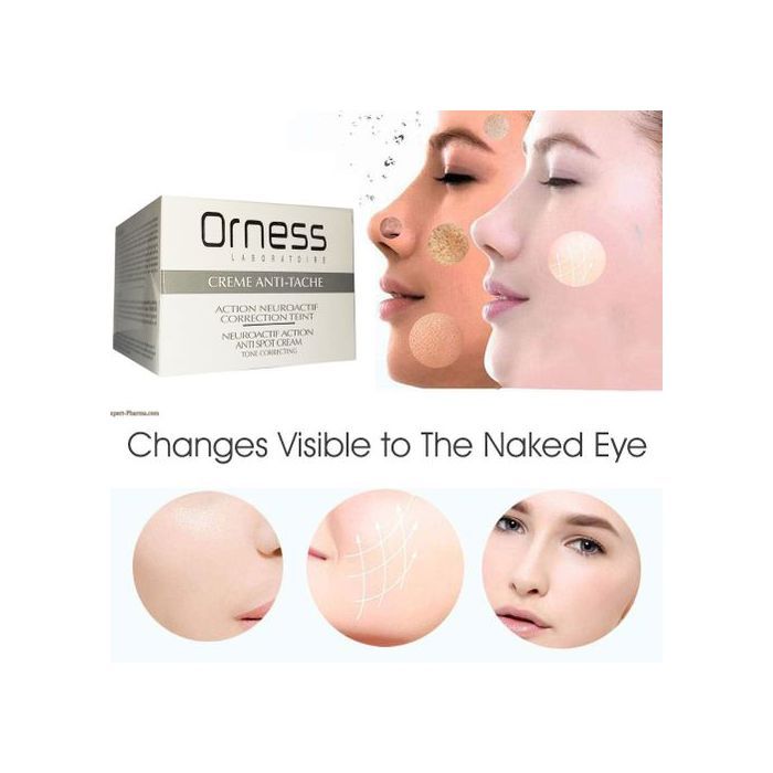Crème Anti-tâches - ORNESS - 50ml - Anti-taches brunes - Soin naturel - Tous types de peau