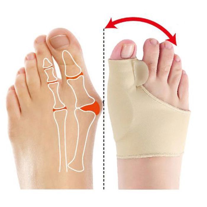 Correcteur orthopédique pour Hallux Valgus Correcteur des doigts Pieds