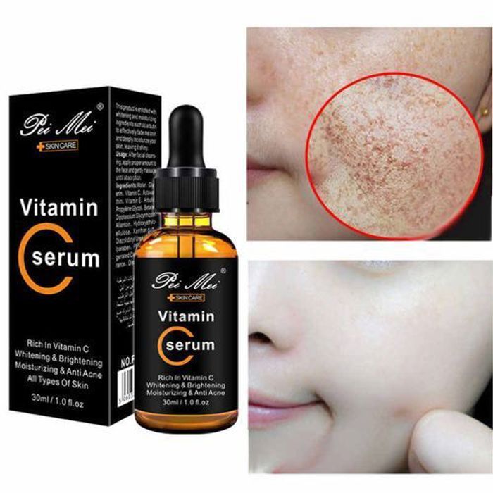 Sérum Visage - Pei Mei - Anti-âge - 30ml - Vitamine C - Sans parabène