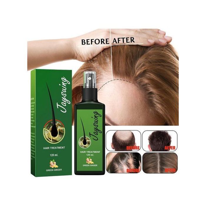 Sérum cheveux anti-chute Jaysuing pour la croissance et repousse des cheveux (120 ml)