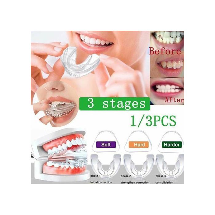 Appareils Dentaires Orthodontiques Invisibles à 3 Étapes, Redresseur, Retenue, Entraîneur Buccal