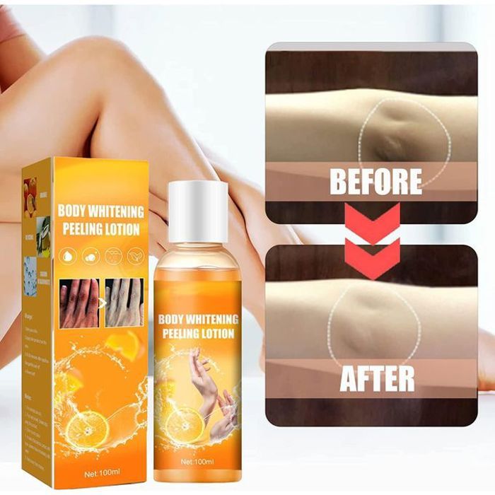 Eelhoe gel de blanchiment instantané pour la peau,genoux,taches foncées ,100ml
