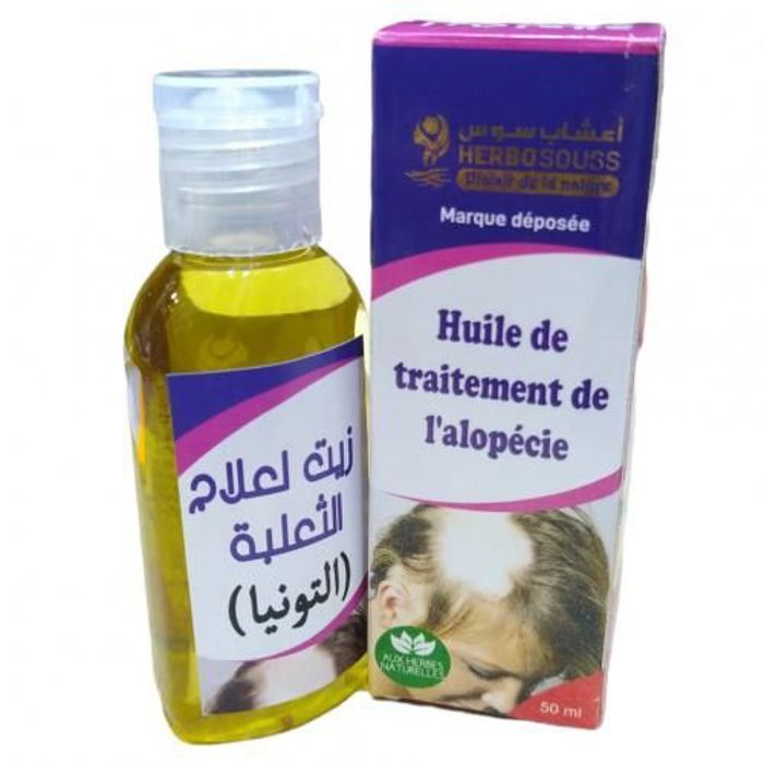 PELADE NERVEUSE