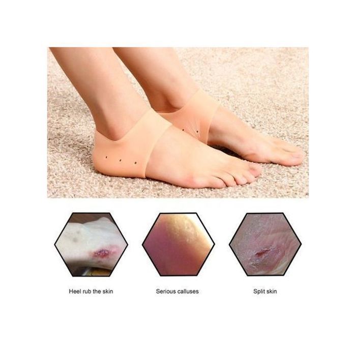 2 pcs Gel Silicone Pied Cassé Talon Chaussettes Protecteur Lavable Non-toxique